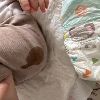 Prima 3 Numara Bezlerde Sürekli Sızdırma Sorunu