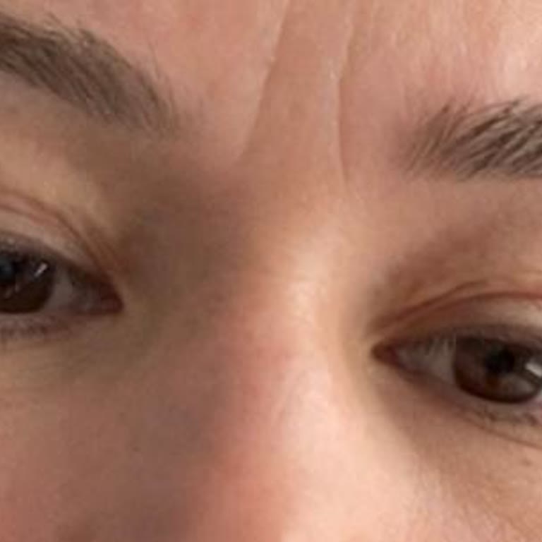 Ameliyat Sonrası Revizyonda Yaşanan Mağduriyet