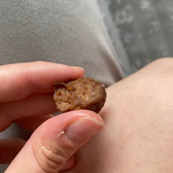 Köftede Yabancı Maddeyle Karşılaştım, Çocuğumun Sağlığı Tehlikeye Girdi