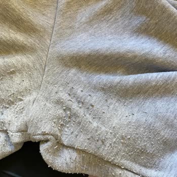 Suud'dan Aldığım Eşofman Altı Kısa Sürede Tiftiklendi, Çözüm Sunulmadı