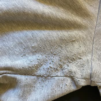 Suud'dan Aldığım Eşofman Altı Kısa Sürede Tiftiklendi, Çözüm Sunulmadı