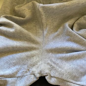 Suud'dan Aldığım Eşofman Altı Kısa Sürede Tiftiklendi, Çözüm Sunulmadı