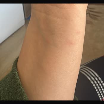 Asena Jewels Çelik Takı Alerji Yaptı, Ücret İadesi Yapılmıyor