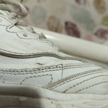 Skechers Ayakkabının Derisi Kısa Sürede Çatladı Garanti Süresinde Destek Alamadım