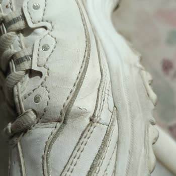 Skechers Ayakkabının Derisi Kısa Sürede Çatladı Garanti Süresinde Destek Alamadım