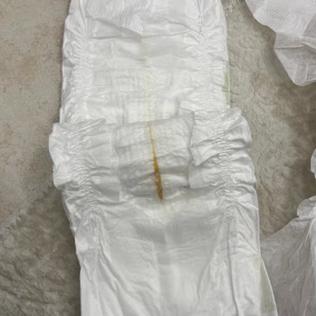 Molfix Bezlerde Beklenmeyen Yabancı Madde Şoku!