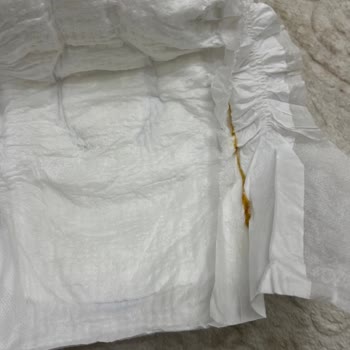 Molfix Bezlerde Beklenmeyen Yabancı Madde Şoku!