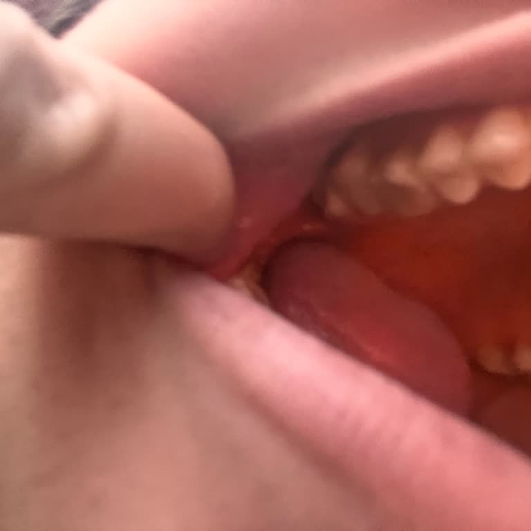 Özel Kevser Ağız Ve Diş Sağlığı Polikliniği Geçici İstediğim Halde Kalıcı Dolgu Yaptı