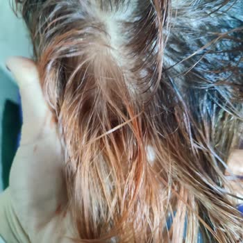 Aldığım Boya Saçımda Farklı Ve Bozuk Renk Oluşturdu, Mağdurum!