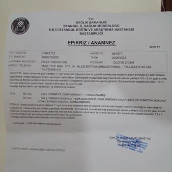 Lazer Epilasyon Sonrası Yüzümde İkinci Derece Yanık Oluştu