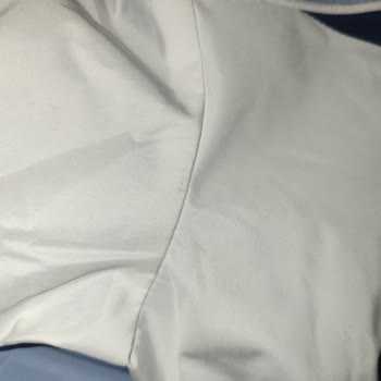 Defolu Ceket Ve Değişim Sorunu: Fiyat Farkı Mağduriyeti