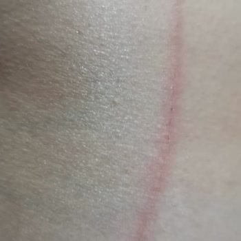 Dalin Sabunda Cam Parçası Tehlikesi Yaşadım