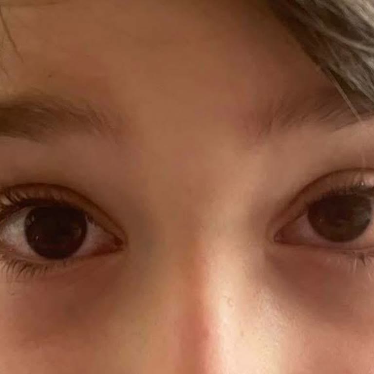 Atasun Optik'ten Yanlış Cam Takılması Sonucu Çocuğumun Göz Sağlığı Zarar Gördü