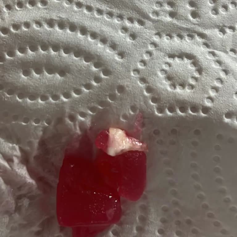 Koska Güllü Lokumda Sert Cisim Diş Kırma Tehlikesi Yaşattı