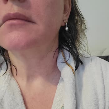 Nivea Yüz Temizleme Jeli Cildimde Şiddetli Alerjiye Sebep Oldu