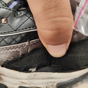 Skechers Ayakkabı Kısa Sürede Açıldı, Değişim Talebi Reddedildi