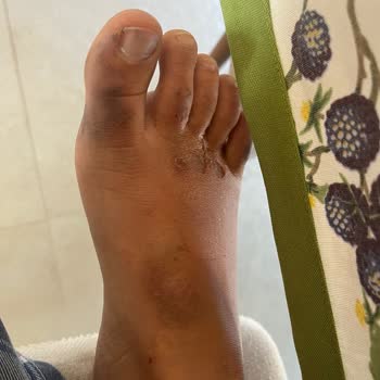 Camper Sandalet İlk Giyişte Boyasını Ayaklarıma Bulaştırdı