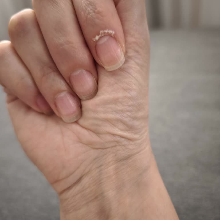 Kosla Vanish Oxi Action Teması Sonrası Deride Beyazlaşma Sorunu