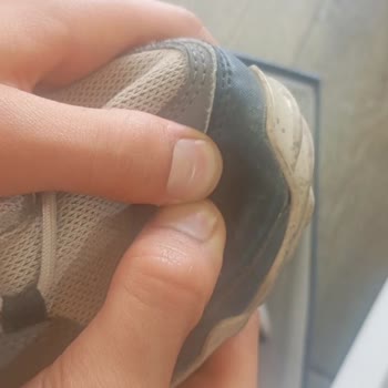 Ayakkabıda Açılma Sorunu Ve Red Edilen Değişim Talebi