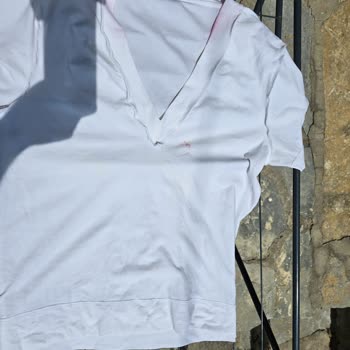 Domestos Kullanımı Sonrası Oluşan Pembe Lekeler Ve Müşteri Hizmetleri Deneyimi