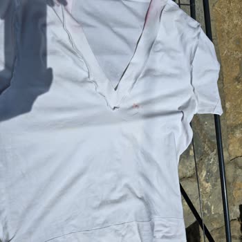 Domestos Kullanımı Sonrası Oluşan Pembe Lekeler Ve Müşteri Hizmetleri Deneyimi