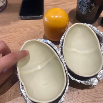 Kinder Sürpriz Yumurtadan Kil Çıkması Ve Müşteri Hizmetlerinin İlgisizliği