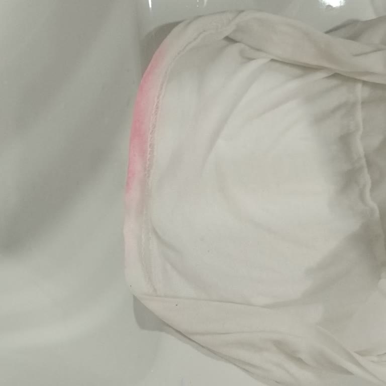 Leke Temizleme Sonrası Üründe Renk Değişimi Ve Yaygın Sorun