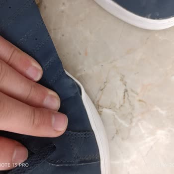 6 Ayda Deforme Olan Ayakkabıya Garanti Reddi Şaşkınlığı