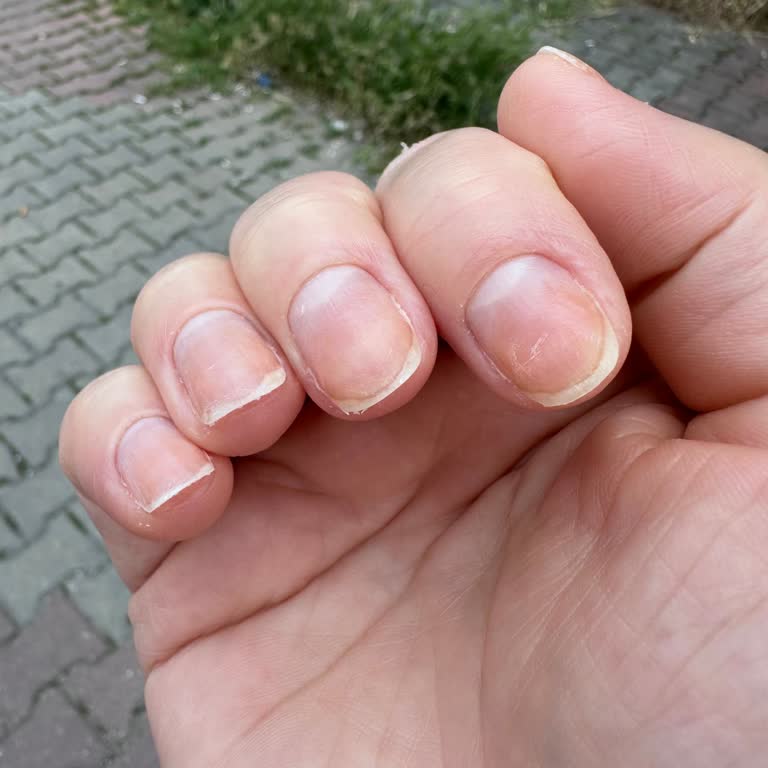 Manikür Hizmetinde Memnuniyetsizlik Ve Profesyonellik Eksikliği