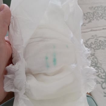 Sleepy 2 Numara Bebek Bezinde Mavi Leke Ve Üretim Hatası