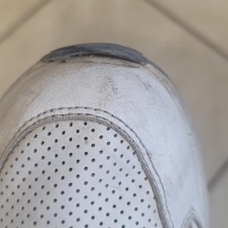 Garanti Süresindeki Skechers Ayakkabım Kullanıcı Hatası Denilerek Reddedildi