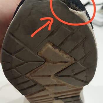 Kısa Sürede Deforme Olan Ayakkabıda FLO'dan Beklenen Destek Sağlanmadı!