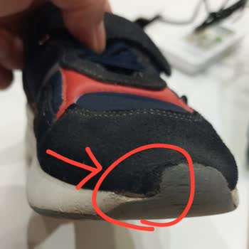 Kısa Sürede Deforme Olan Ayakkabıda FLO'dan Beklenen Destek Sağlanmadı!