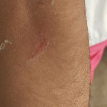 Otel Odasında Güvenlik Sorunu Ve Yaralanma