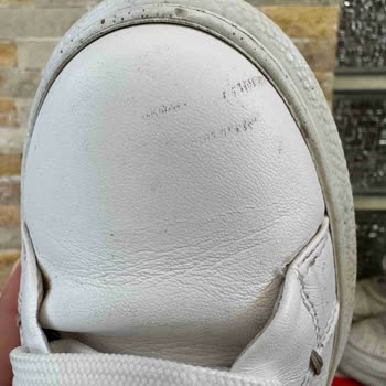 Derimod Ayakkabılarda Deri Soyulması Ve İlgisiz Mağaza Yaklaşımı