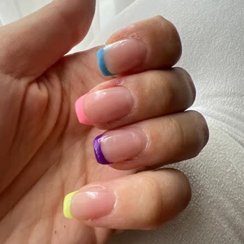 Kadıköy Fikirtepe Şubesinde Kötü Hizmet Ve Sağlıksız Uygulama