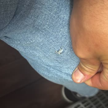 Otobüs Koltuğundaki Deformasyon Nedeniyle Yaralanma Ve Personel İlgisizliği