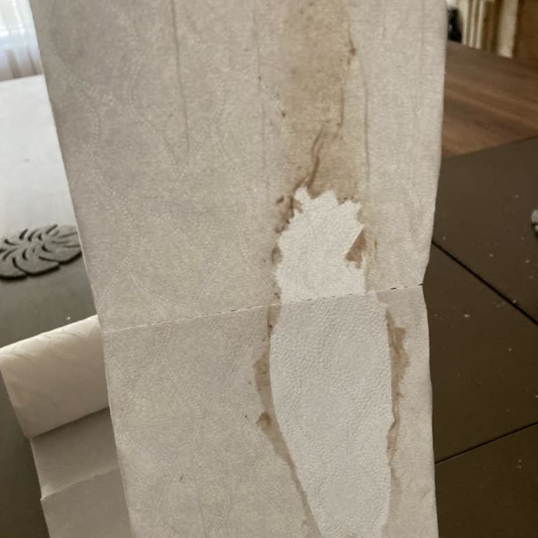 Aldığım Tuvalet Kağıdında Hijyen Sorunu Yaşadım