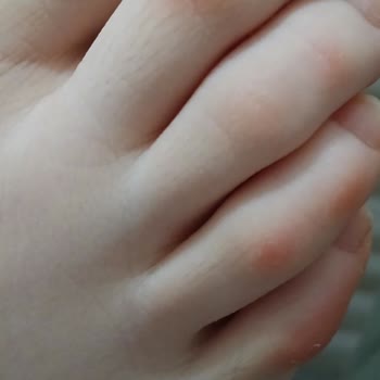 Aldığım Spor Ayakkabı Oğlumun Ayağını Yaraladı Değişim Reddedildi