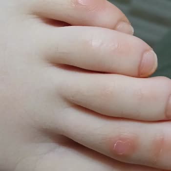 Aldığım Spor Ayakkabı Oğlumun Ayağını Yaraladı Değişim Reddedildi