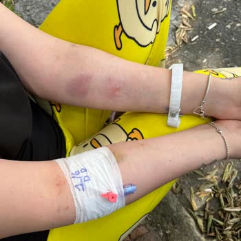 Yedikule Hastanesi Hastanede Kötü Muamele ve Hijyen Sorunları Yaşadım