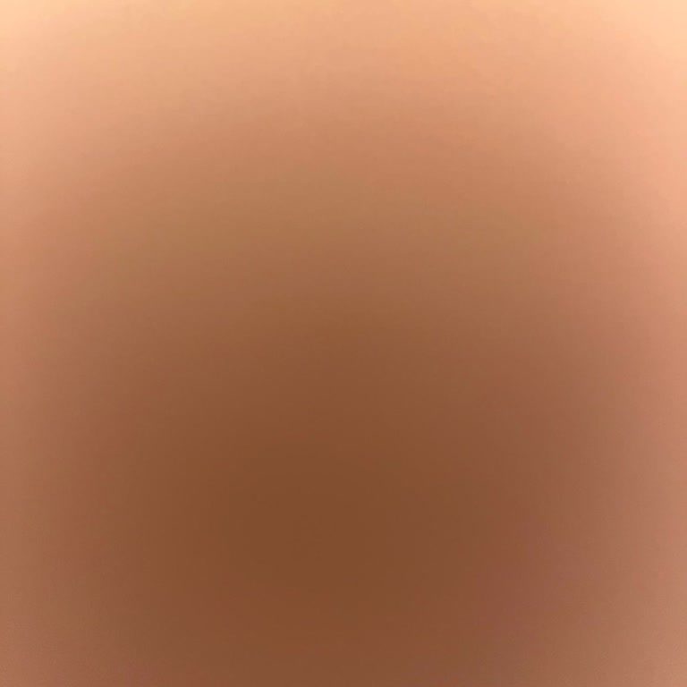 Kısa Sürede Hasar Gören Çantamın İadesi Hala Sonuçlanmadı