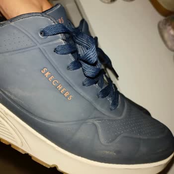 Skechers Ayakkabı Ayağımda Yara Oluşturdu, Memnun Kalmadım