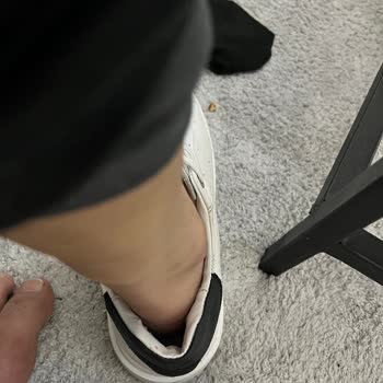 Kısa Sürede Deforme Olan Ayakkabıya Çözüm Bekliyorum