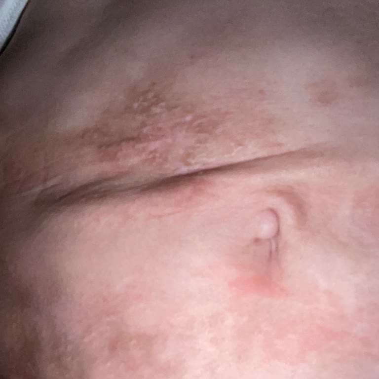 Dr. Bilgehan Aydın Yanlış Ameliyat Sonrası Yaşanan Ciddi Sağlık Sorunları