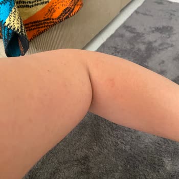 Hediye Monoi Yağ Alerji Yaptı, Sade Seçeneği Verilmedi