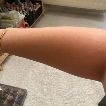 Hediye Monoi Yağ Alerji Yaptı, Sade Seçeneği Verilmedi