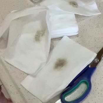 Yenidoğan Mendilinde Küf Şoku: Hijyen Skandalı