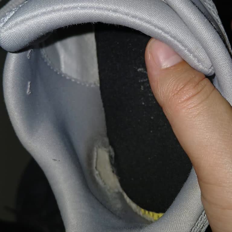 Adidas Ayakkabımın Yırtığı Garanti Kapsamında Kabul Edilmedi