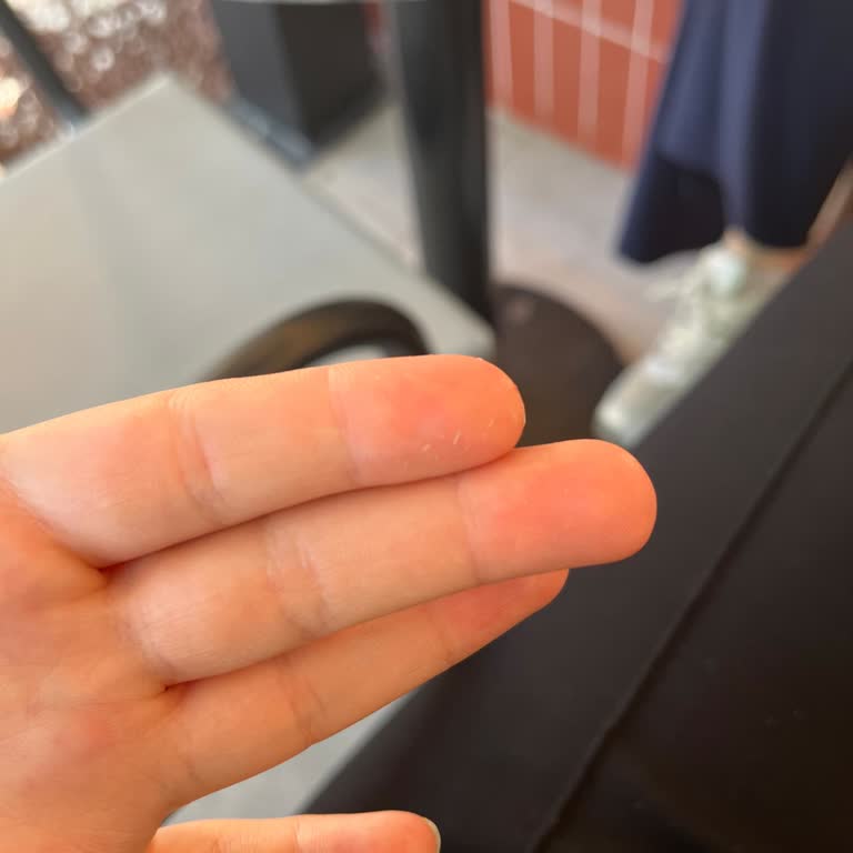 Aldığım Duaderm Bariyer Krem Bozuk Çıktı, Ciltte Sorun Yarattı